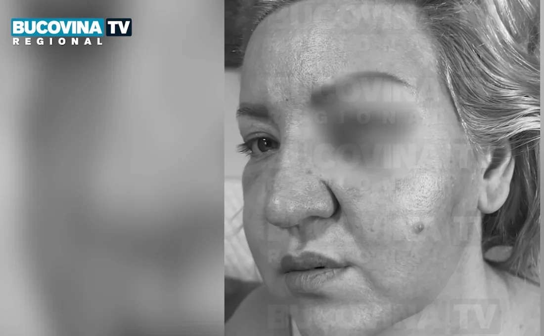 Mamă și fiică agresate de primarul Reziuc